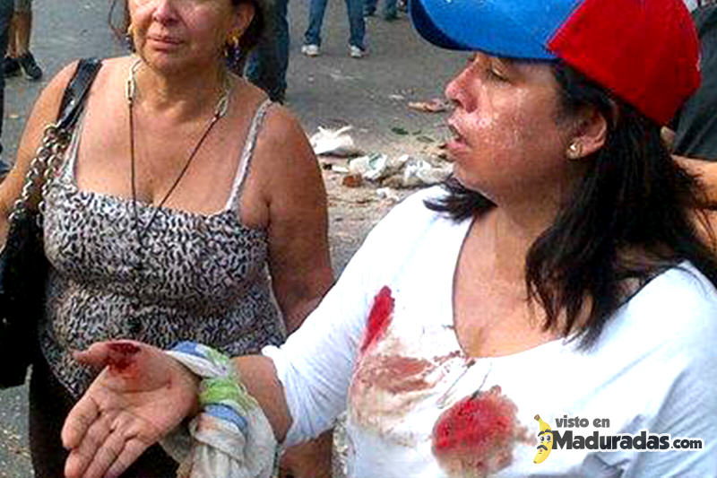 estudiantes heridos por la gnb protesta