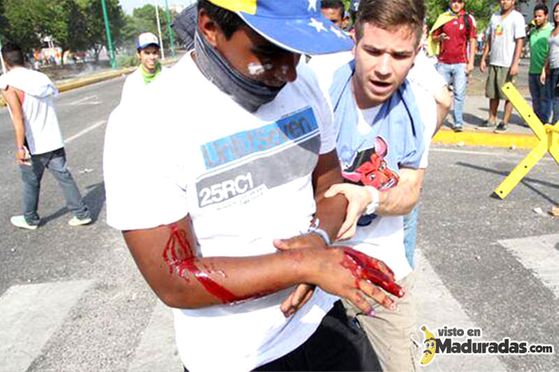 Manifestante agredido con perdigones.