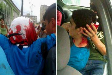 ¡GRAVE! Hieren de bala en la cabeza a estudiante en protesta en Barquisimeto + FOTO