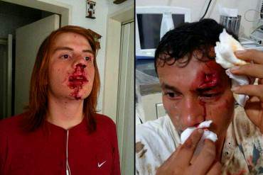 ¡BRUTAL ATAQUE! Paramilitares amparados por la PNB arremetieron contra estudiantes (Fotos)