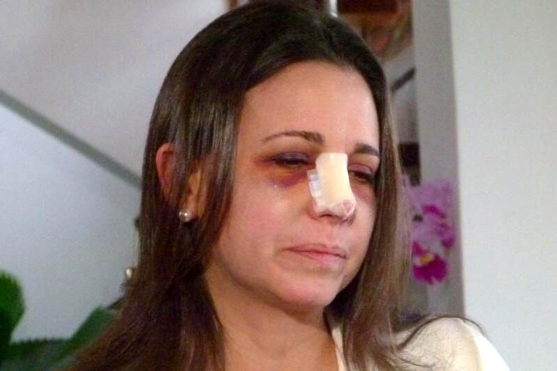 Maria Corina Machado golpeada por Nancy Ascencio