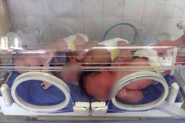¡LA MISERIA COMUNISTA! Así tienen a recién nacidos en el Hospital Chiquinquirá de Maracaibo