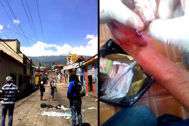 ¡CONTINÚA LA REPRESIÓN! Reportan estudiantes heridos en protesta en la UCAT, Táchira (+Fotos)