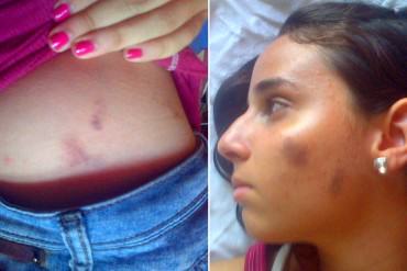 ¡YA ES DEMASIADO! Joven fue salvajemente golpeada por colectivos durante visita de Lilian Tintori