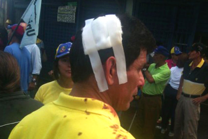 herido-en-marcha-capriles