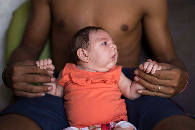 Dejailson Arruda sostiene a su hija Luiza en su casa de Santa Cruz do Capibaribe, en el estado de Pernambuco, Brasil. Luiza nació en octubre con una afección poco habitual conocida como microcefalia. La madre de Luiza, Angelica Pereira, se vio infectada por el virus del zika durate su embarazo por una picadura de mosquito. Las autoridades brasileñas de salud creen que la afección de Luiza está relacionada con la infección que sufrió su madre. (AP Foto/Felipe Dana)