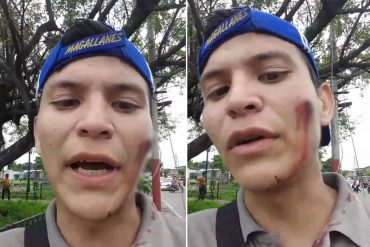 ¡GNB COBARDE! Con perdigones en el rostro fue herido periodista durante marcha opositora (+Video)