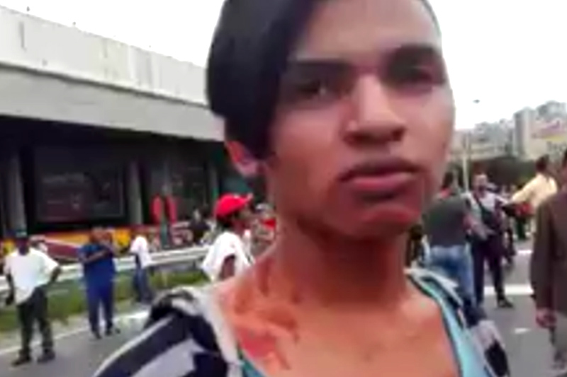 joven-agredido-en-marcha-opositora