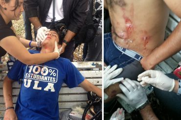 ¿QUIÉNES SON LOS VIOLENTOS? Varios estudiantes heridos tras ola represiva de PoliMérida