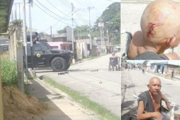 ¡SALVAJADA! Abuelo discapacitado fue herido durante represión de protesta en Tucupita (+Fotos)