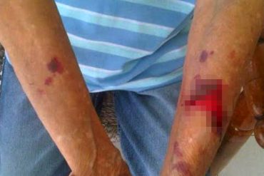 ¡INDIGNANTE! Denuncian brutal agresión de la GNB en contra de abuela en Bicentenario de Falcón