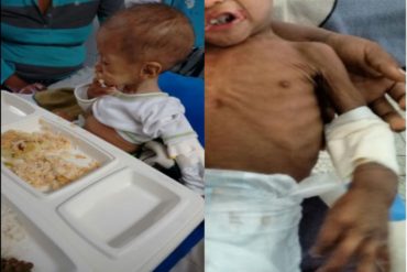 ¡DUELE EN EL ALMA! Niños venezolanos siguen muriendo de hambre y desnutrición (+Fotos)