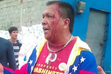 ¡ATENCIÓN! Oficialistas agredieron a coordinador de Primero Justicia en Trujillo