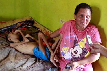 ¡DESGARRADOR! Padre entre lágrimas: “A mi hijo lo mata el hambre” (Tiene 15 años y solo pesa 10Kg)