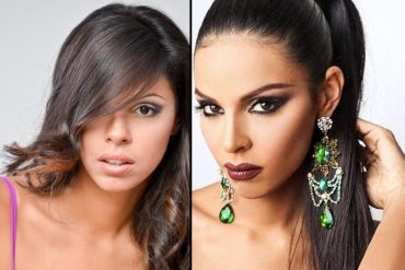 ¡ERA OTRA! Keysi Sayago, Miss Venezuela 2016, pasó varias veces por el quirófano (+Fotos)