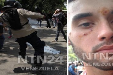 ¡URGENTE! Así reprimen protesta de estudiantes de la UCV (a chavistas ni con el pétalo de una rosa)