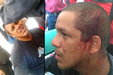 ¡DOSIS DE PATRIA! Oswaldo Rivero “Cabeza e’ Mango” fue herido por grupo chavista que asaltó la AN