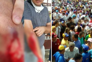 ¡SIGUE LA REPRESIÓN! Reportan un herido de perdigón durante manifestación en Coro