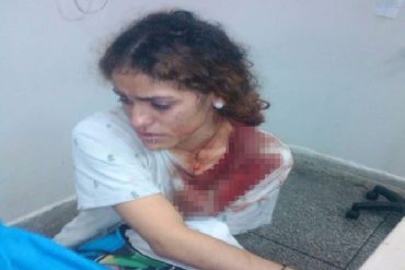 ¡ABUSO! Funcionarios golpearon en Barinas a joven que NO estaba protestando: le rompieron la cabeza de un cachazo