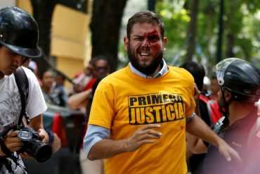 ¡SEGUIMOS EN LA CALLE! Habla Juan Requesens tras la agresión: “Esto con punto y reposo se cura, nada nos va a callar” (+Video)