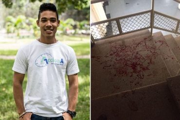 ¡INSEGURIDAD! Tirotearon a un estudiante de Antropología dentro de la UCV: lo querían robar