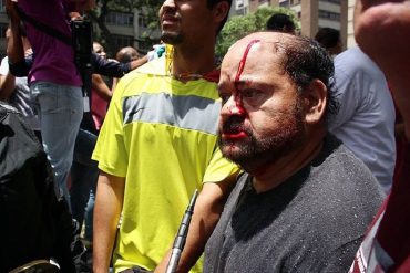 ¡ABUSO TOTAL! Ganador del Premio Pavarotti (aclamado tenor) también fue agredido por PNB en protesta