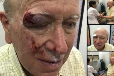 ¡INDIGNANTE! Abuelo de 80 años fue brutalmente agredido en marcha opositora (+Fotos)