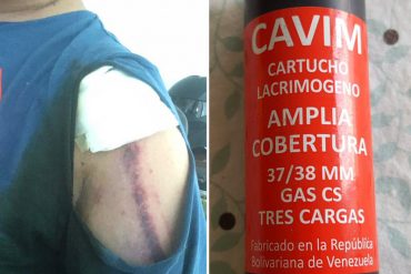 ¡REPUDIABLE! Con bombazo a quemarropa resultó herido fotógrafo de EFE en represión a marcha opositora