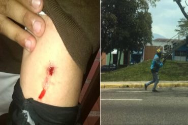 ¡ENTÉRESE! Ataques de colectivos habrían dejado un herido de bala en Táchira