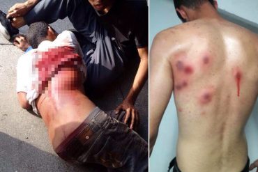 ¡URGENTE! Brutal represión a estudiantes en la Universidad de Carabobo: Reportan heridos de bala