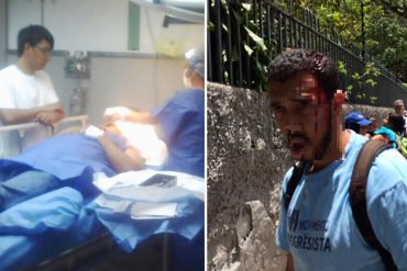 ¡SALVAJES! Activista de VP herido de gravedad tras golpe de policías en el cráneo (40 puntos)