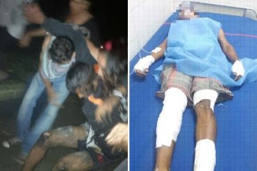 ¡QUÉ HORROR! Arrollaron a un joven mientras tocaba cacerolas en Guayana