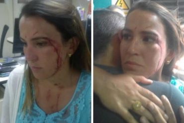 ¡QUÉ BAJEZA! Periodista fue atacada por supuestos colectivos en la avenida Lecuna: tiene heridas en el rostro