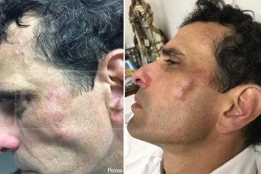 ¡URGENTE! GNB agredió a golpes a Henrique Capriles en emboscada a él y su equipo (+Fotos)