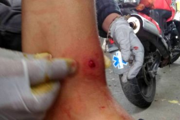 ¡URGENTE! Reportan heridos durante brutal represión en Las Mercedes (+Video)