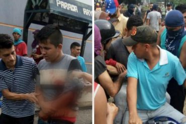 ¡ÚLTIMA HORA! Joven fue herido de bala en Los Pozones en Barinas: le disparó la GNB #22May