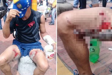 ¡SALVAJISMO! Reportan herido con granada durante represión en la autopista Francisco Fajardo