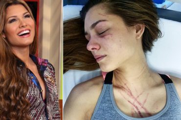 ¡FOTO IMPACTANTE! Así quedó Osmariel Villalobos tras brutal golpiza con Diosa Canales