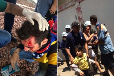 ¡LO ÚLTIMO! Brutal represión en Maracaibo este #16Jun: un joven herido en la frente por lacrimógena y niños asfixiados