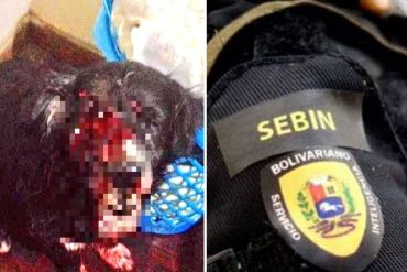 ¡ENTÉRATE! Lo que dijo la ama de Cross, el perrito al que el Sebin le disparó en Los Verdes