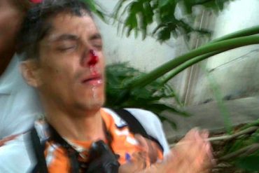 ¡URGENTE! Dos manifestantes heridos en el rostro durante represión en la Francisco Fajardo (Video)