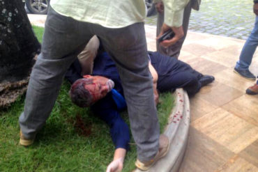 ¡URGENTE! Agreden a diputado Américo De Grazia en ataque a la AN: podría tener costillas fracturadas (+Fotos)
