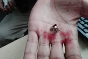 ¡QUE SE SEPA! Diputado Guanipa mostró casquillos de balas tras ataque de colectivos en la AN (+Fotos de los destrozos)