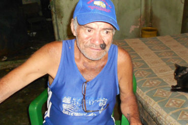 ¡DESGRACIA PAÍS! El llamado desesperado que hace este abuelito enfermo del corazón por ayuda: «Solo me quedan tres meses»