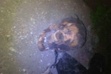 ¡MADRE SUSTO! Estaba cavando en su casa nueva en Barquisimeto y encontró una osamenta entera