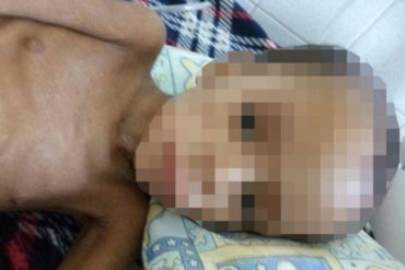 ¡LAMENTABLE! Muere en Guayana niño Warao con cuadro de desnutrición