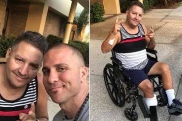 ¡COMUNISMO EN ACCIÓN! En un hospital de Cuba le curaron una herida con vinagre y le tuvieron que amputar la pierna