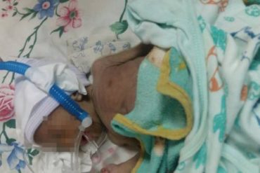 ¡Y MADURO BAILANDO! Falleció bebé de 6 meses por desnutrición en Ciudad Guayana (este año han muerto al menos 19 niños)