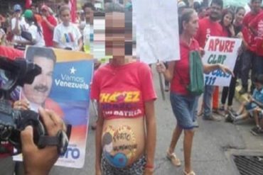 ¡MÍRELA! Adolescente embarazada fue la protagonista de una concentración oficialista en Apure