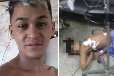 ¡SOLO EN VENEZUELA! Alias «El Ney» fue acribillado a tiros en la emergencia del Hospital Domingo Luciani